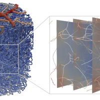 Webinar on Stroke across scales – impact on blood perfusion and oxygen supply in the brain – a computational perspective