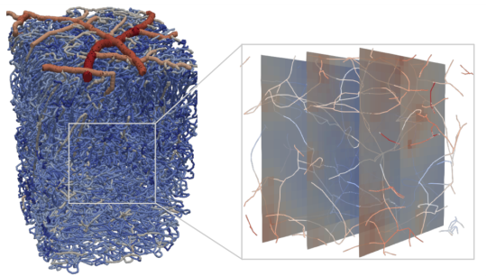 Stroke across scales β impact on blood perfusion and oxygen supply in the brain